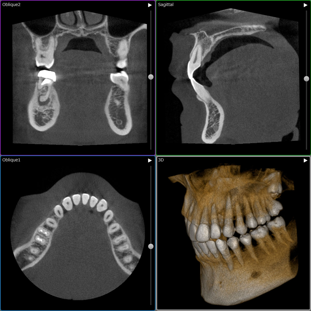 歯科用CT　SOLIO X